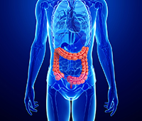 Irritable bowel disease Causes
